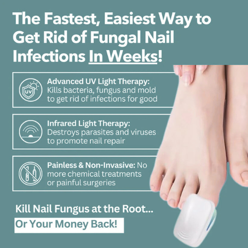 EBIN™ - Nail Fungus Laser Device